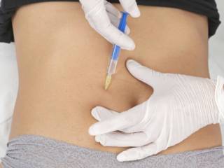 Aplicação de Enzimas - Intradermoterapia