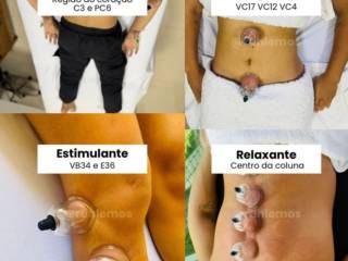 Benefícios da Ventosaterapia