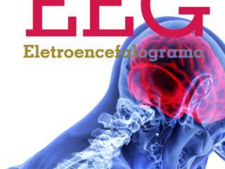EEG – Eletroencefalograma