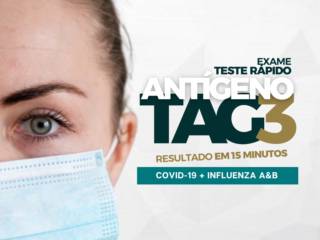 Exame Teste Rápido Antígeno TAG3