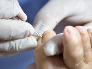 Pés que Encantam: A Arte da Podologia na Posê Mineiros