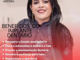 Conheça Os Principais Benefícios do Implante Dentário!