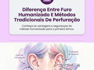 Diferença Entre Furo Humanizado E Métodos Tradicionais De Perfuração