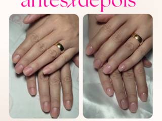 O que é bindagem de unhas e para que serve?