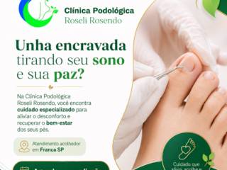 Se voce sofre com unha encravada e esta unha esta tirando o seu sono e sua paz a clínica de podologia Roseli Rosendo pode te ajudar