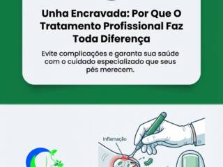 Unha Encravada: Por Que O Tratamento Profissional Faz Toda Diferença