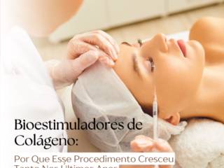 Bioestimuladores de Colágeno em Itapetininga: Por Que Esse Procedimento Cresceu Tanto Nos Últimos Anos