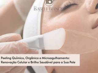 Peeling Químico, Orgânico e Microagulhamento: Renovação Celular e Brilho Saudável para a Sua Pele