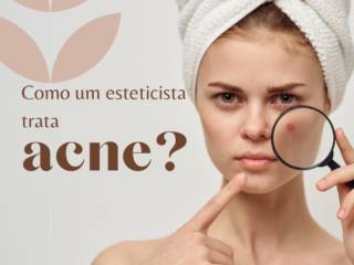 Como o esteticista trata a acne?