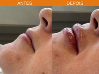 Realçando a beleza dos seus lábios. Contorno, volume e hidratação!