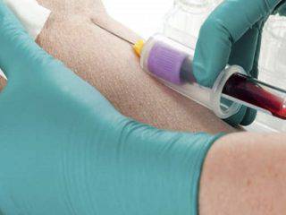 Saiba a importância de realizar o hemograma completo