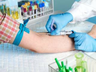 Por que fazer jejum para exame de sangue é tão importante?