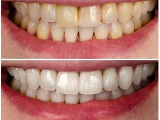 Um sorriso renovado, com naturalidade e harmonia.