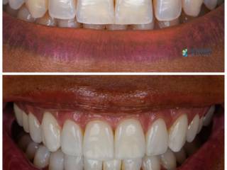 Quando o sorriso reflete exatamente quem você é. 