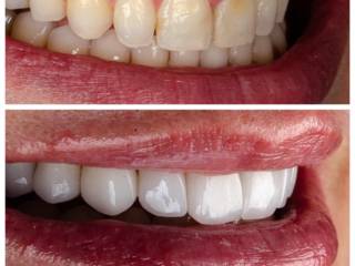 Quando o sorriso reflete exatamente quem você é. 