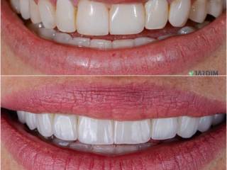 Sorrir é iluminar o que você tem de mais autêntico.