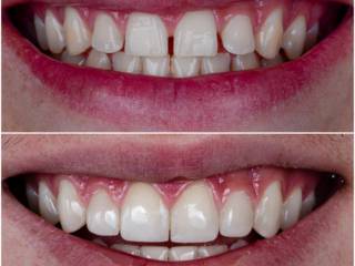 De um sorriso infantil a um sorriso confiante. 