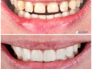 Quando o tempo parece correr mais rápido para o sorriso.