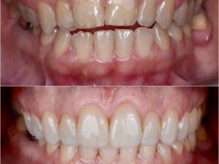 Transformando sorrisos com técnica, planejamento e estética.