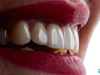 Como Um Atendimento Humanizado Muda a Experiência no Dentista