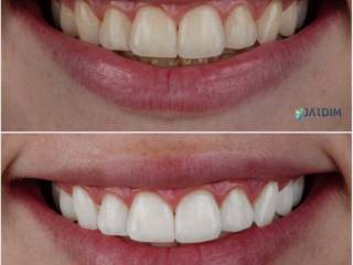 Um sorriso mais iluminado faz toda a diferença!