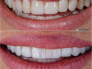 Um sorriso renovado com naturalidade e elegância.