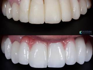 Cada detalhe faz diferença na reconstrução de um sorriso.