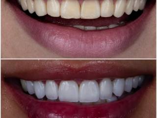 Cada detalhe faz diferença no seu sorriso