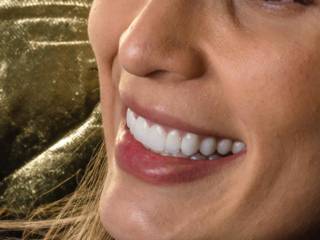 Um novo sorriso, sem perder a essência