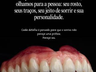 Prótese dentária personalizada em Francisco Beltrão