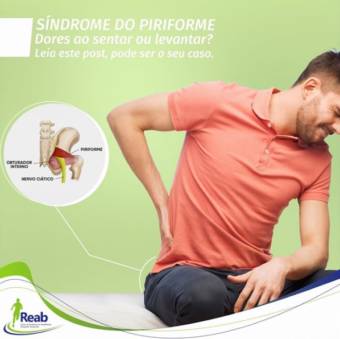 Síndrome do Piriforme: O Que É, Principais Sintomas e Como Tratar.
