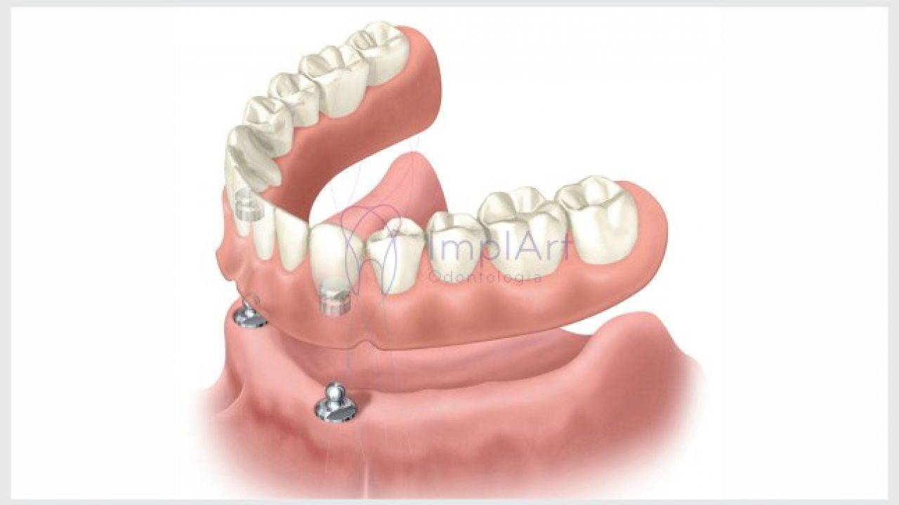 Ortodontia pode resolver DTM? - Dentista em Foz do Iguaçu - Aparelho  Ortodôntico - Facetas - Implantes - Próteses - Prime Sorriso Odontologia