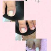 Unha do pé com esmaltaçao e francesinha 