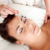 Acupuntura ou Medicina Ocidental