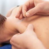 Agulhamento Seco - Dry Needling