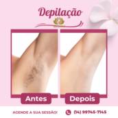 Depilação com Cera de Algas