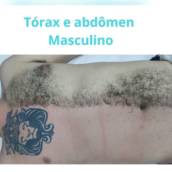 Depilação Tórax a Abdômen Masculino 