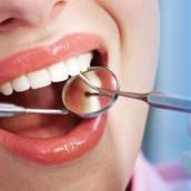 Tratamento para Caries