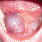 Estomatologia  e Diagnóstico Oral