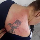 Gua - sha