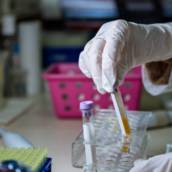 Exame Toxicológico