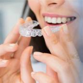 Estética Dental