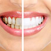 Dentística (restauração)