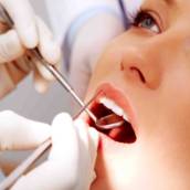 Endo (canal)