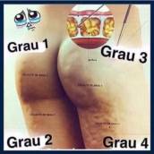 TRATAMENTO PARA CADA GRAU DE CELULITE 