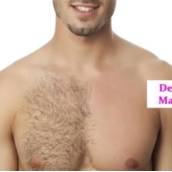 Depilação Masculina em Avaré