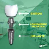 Coroa de Porcelana em Bauru