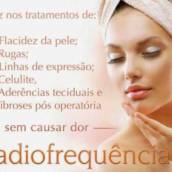 Radiofrequência