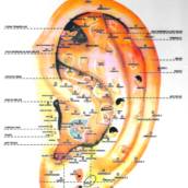 Tratamento de auriculoterapia