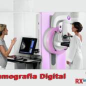 Mamografia Digital